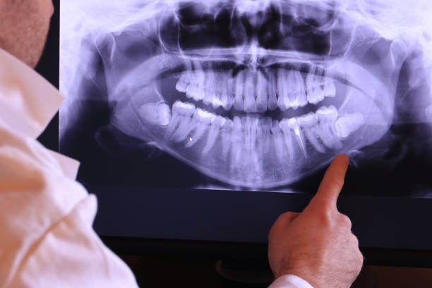 Best Emergency Dentist for Lost Fillings or Crowns in Tiffin, IA